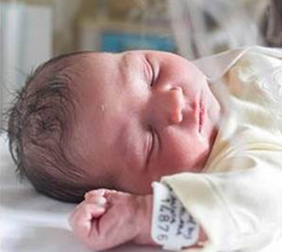 Le cure del neonato